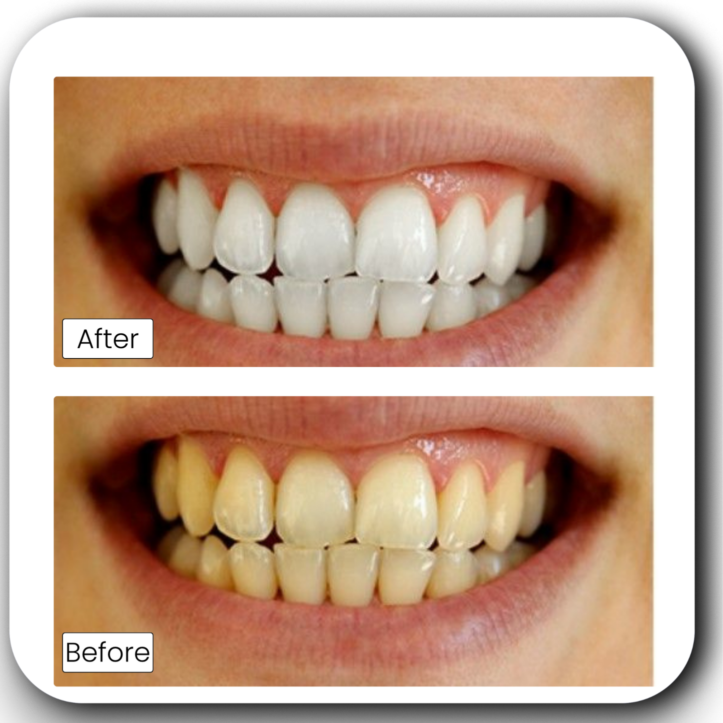 Teeth Whitening Powder