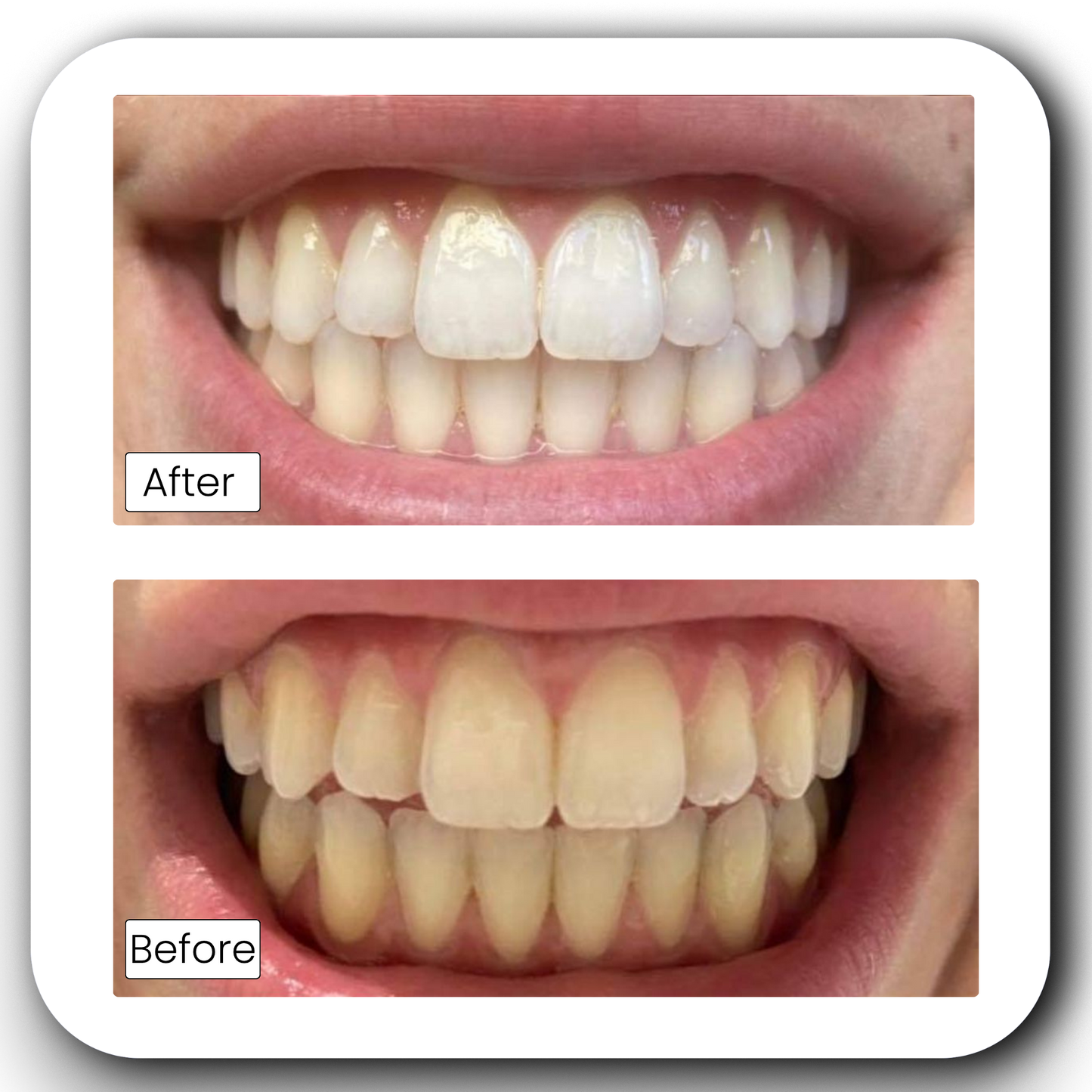 Teeth Whitening Powder