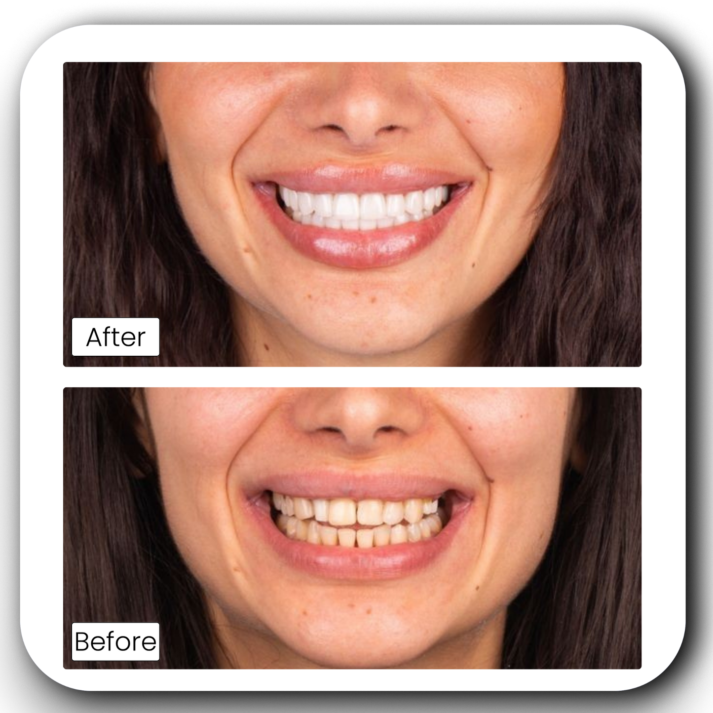Teeth Whitening Powder
