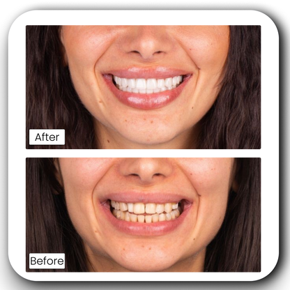 Teeth Whitening Powder