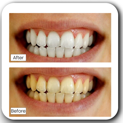 Teeth Whitening Powder