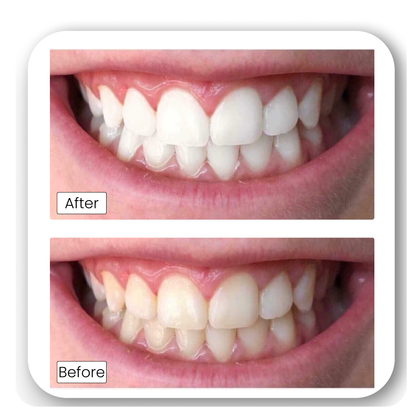 Teeth Whitening Powder