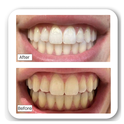 Teeth Whitening Powder